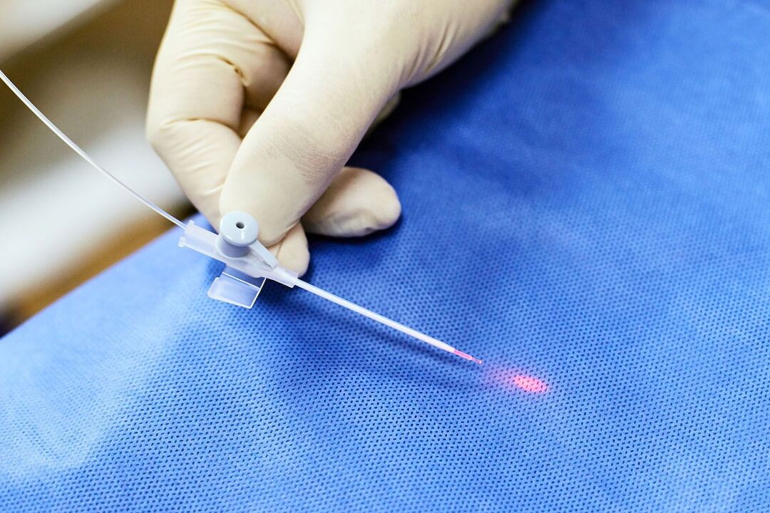 rectal device for prostate treatment